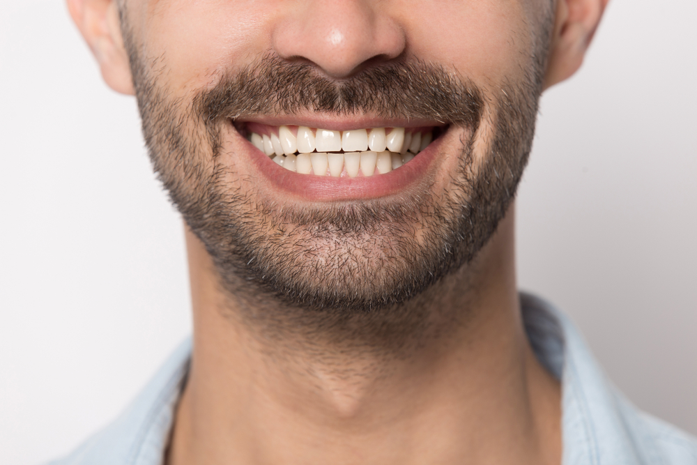 Close-up of healthy white teeth showcasing the results of professional dental care at a Scotts Valley family dentist 